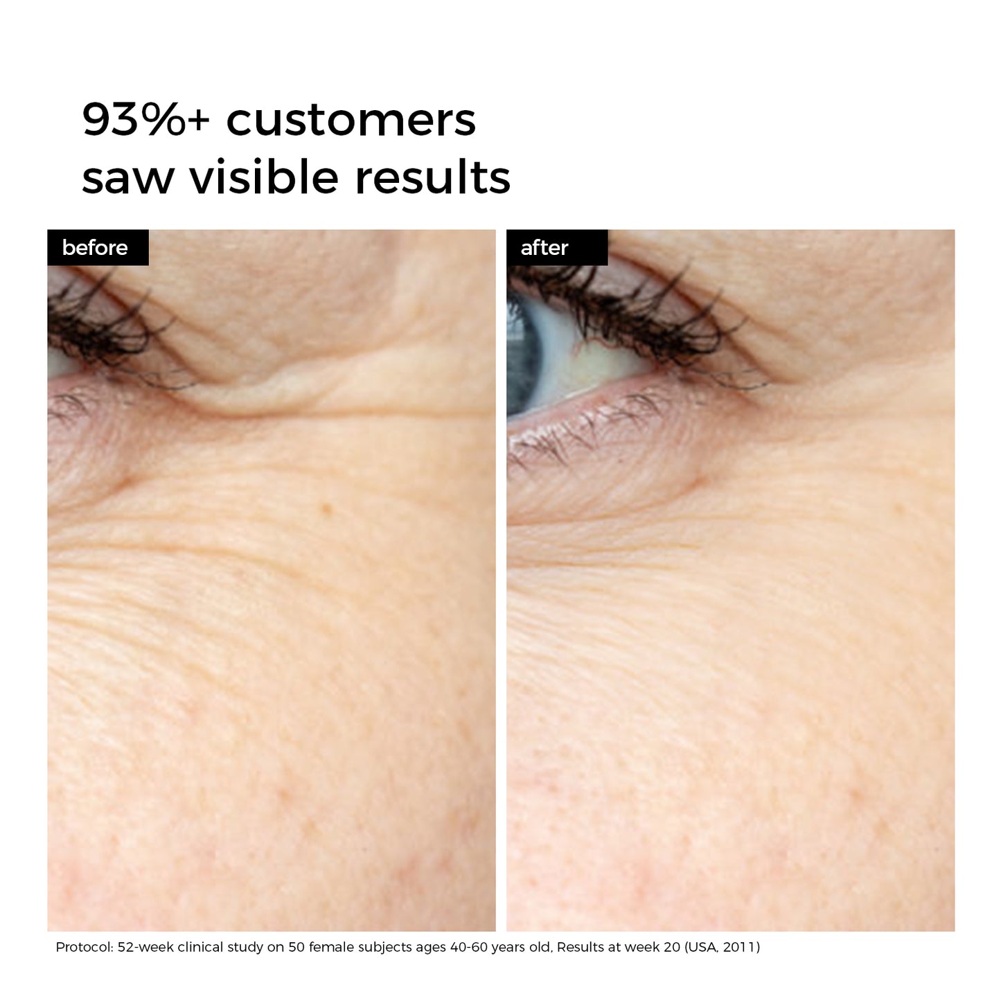 WNP Emergency Repair and Firming Oil-Suspension Serum