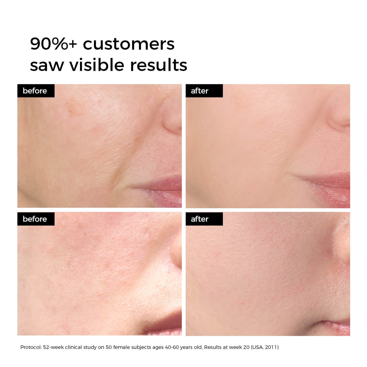 WNP 3% Hyaluronic Acid Serum